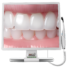 19 inches hd monitor with wifi dental intraoral camera system