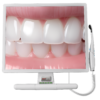 ski hd intra oral camera for medical oral 12 megapixel
